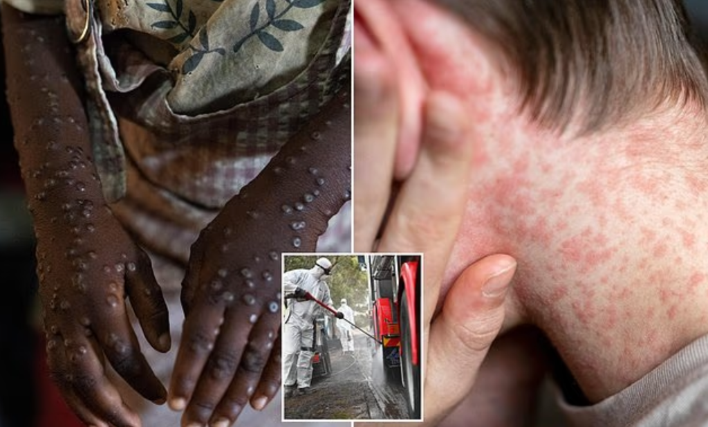 Ở ngưỡng cửa đại dịch? Những virus khiến giới khoa học lo ngại trong năm 2026